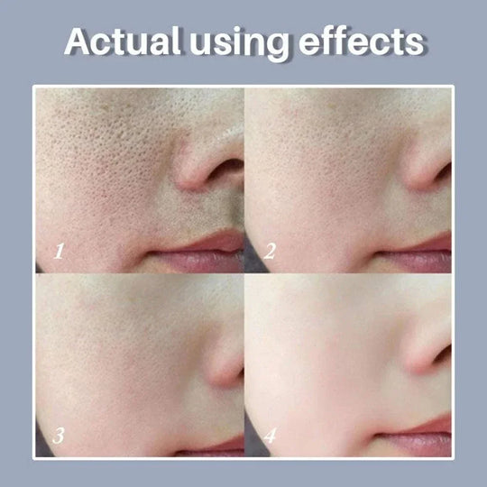 Skin Texture | Pore Refining Resurfacing, Brightening Facial Serum